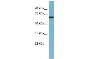 CAP1 antibody used at 1 ug/ml to detect target protein. (CAP1 antibody)
