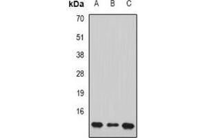Western blot analysis of PC4 expression in HL60 (A), Jurkat (B), mouse brain (C) whole cell lysates.