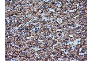 Immunohistochemical staining of paraffin-embedded Human liver tissue using anti-ARG1 mouse monoclonal antibody. (Liver Arginase antibody)