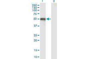 Western Blot analysis of OXCT1 expression in transfected 293T cell line by OXCT1 MaxPab polyclonal antibody. (OXCT1 antibody  (AA 1-520))