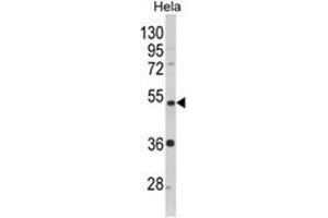 Western blot analysis of PPP2R2B Antibody (Center) in Hela cell line lysates (35ug/lane). (PPP2R2B antibody  (AA 110-139))