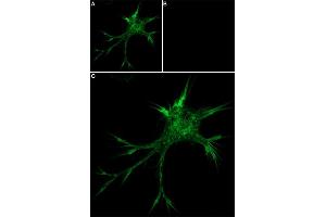 Unlabeled ω-Conotoxin MVIIC successfully blocks ω-Conotoxin MVIIC-Biotin binding.