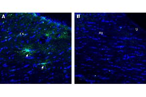 Immunohistochemical staining of perfusion-fixed frozen mouse brain sections using Anti-TMEM108 (extracellular) Antibody (ABIN7885615), (1:300), followed by goat anti-rabbit-. (TMEM108 antibody  (Extracellular Loop))