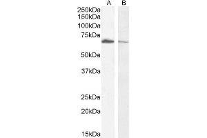 (ABIN185357) (0. (Acetylcholinesterase antibody  (C-Term))
