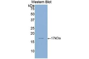 Detection of Recombinant LAMa1, Human using Polyclonal Antibody to Laminin Alpha 1 (LAMA1) (Laminin alpha 1 antibody  (AA 2613-2746))