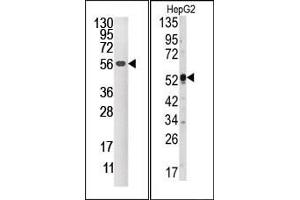 Image no. 1 for anti-Dual Specificity Phosphatase 4 (DUSP4) (C-Term) antibody (ABIN360778) (DUSP4 antibody  (C-Term))