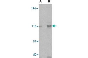 Western blot analysis of KIF5A in K-562 cell lysate with KIF5A polyclonal antibody  at (A) 0. (KIF5A antibody  (C-Term))