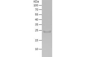 PNLIP Protein (AA 17-226) (His tag)