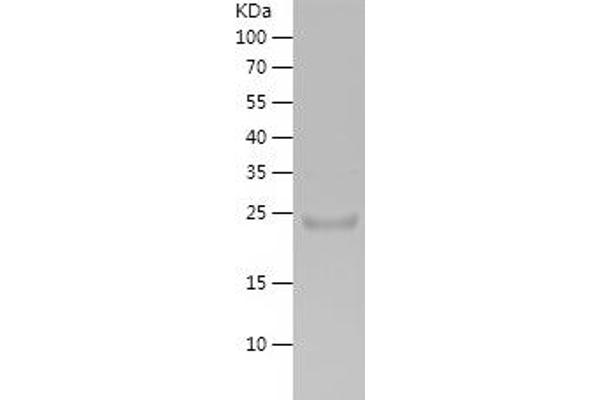 PNLIP Protein (AA 17-226) (His tag)