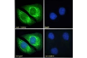 ABIN190911 Immunofluorescence analysis of paraformaldehyde fixed HeLa cells, permeabilized with 0. (TRAF2 antibody  (C-Term))