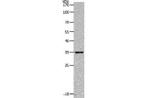 Western blot analysis of Human fetal kidney tissue, using MC2R Polyclonal Antibody at dilution of 1:1400 (MC2R antibody)