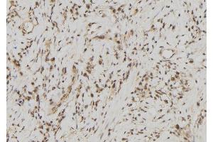 ABIN6278171 at 1/100 staining Human gastric tissue by IHC-P.