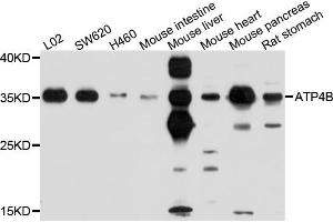 Western blot analysis of extracts of various cell lines, using ATP4B antibody (ABIN4902983) at 1:1000 dilution. (ATP4b antibody)
