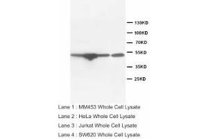 Image no. 2 for anti-Endothelin Receptor Type B (EDNRB) (Internal Region) antibody (ABIN1490394) (EDNRB antibody  (Internal Region))