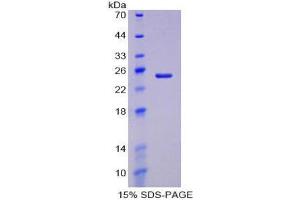 SDS-PAGE (SDS) image for Haptoglobin (HP) (AA 123-307) protein (His tag) (ABIN2121201) (Haptoglobin Protein (HP) (AA 123-307) (His tag))