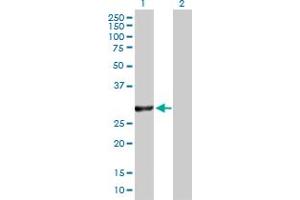 Western Blot analysis of VAPB expression in transfected 293T cell line by VAPB MaxPab polyclonal antibody.