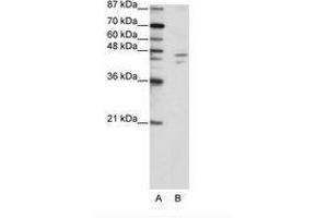 Image no. 1 for anti-Zinc Finger Protein 419 (ZNF419) (C-Term) antibody (ABIN202693)