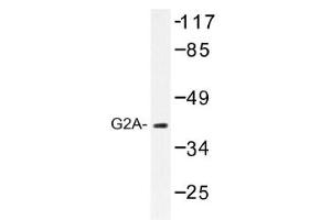 Image no. 1 for anti-G Protein-Coupled Receptor 132 (GPR132) antibody (ABIN317643) (G Protein-Coupled Receptor 132 antibody)