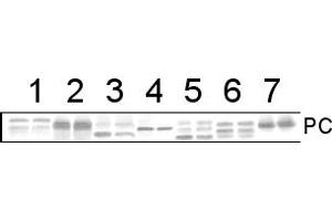 Image no. 1 for anti-PC antibody (ABIN3197484) (PC antibody)