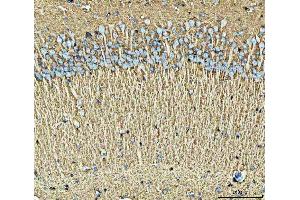 IHC analysis of EAAT2/GLT-1/SLC1A2 using anti-EAAT2/GLT-1/SLC1A2 antibody (ABIN3043436).