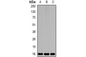Western blot analysis of MsrB2 expression in mouse kidney (A), mouse brain (B), rat liver (C) whole cell lysates. (MSRB2 antibody)