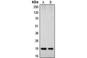 Western blot analysis of Beta-synuclein expression in HeLa (A), human brain (B) whole cell lysates.