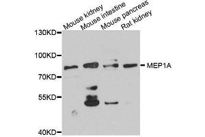 Western blot analysis of extracts of various cell lines, using MEP1A antibody. (MEP1A antibody  (AA 440-700))