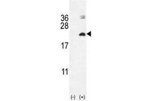 Western blot analysis of IL17F antibody and 293 cell lysate (2 ug/lane) either nontransfected (Lane 1) or transiently transfected with the IL17F gene (2). (IL17F antibody  (AA 16-45))