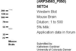 Image no. 2 for anti-SET Domain Containing 4 (SETD4) (C-Term) antibody (ABIN2775875) (SETD4 antibody  (C-Term))