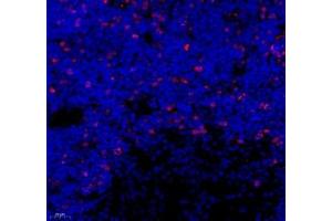 Immunofluorescence of paraffin embedded rat thymus using Top2 (ABIN7075937) at dilution of 1:500 (400x lens) (Topoisomerase II alpha antibody)