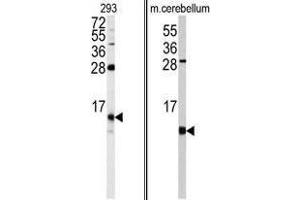 Image no. 1 for anti-FK506 Binding Protein 1B, 12.6 KDa (FKBP1B) (N-Term) antibody (ABIN453013) (FKBP1B antibody  (N-Term))