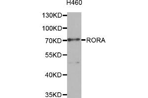 Western blot analysis of extracts of H460 cells, using RORA antibody (ABIN5974193) at 1/1000 dilution. (RORA antibody)