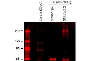 Immunoprecipitation (IP) image for anti-Calcium Channel, Voltage-Dependent, L Type, alpha 1C Subunit (CACNA1C) (AA 1507-1733) antibody (ABIN361759)