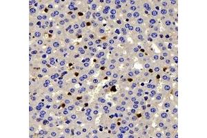 Immunohistochemistry of paraffin embedded mouse liver using IL-2 Receptor alpha (ABIN7074349) at dilution of 1: 200 (400x lens) (CD25 antibody)