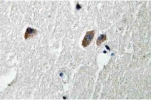 Immunohistochemistry (IHC) analyzes of CaMKIIbeta/gamma/delta antibody in paraffin-embedded human brain tissue. (CAMK2B antibody)