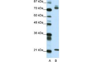 WB Suggested Anti-SATB1 Antibody Titration: 0. (SATB1 antibody  (C-Term))