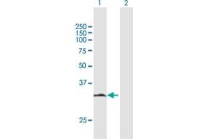 Western Blot analysis of HDGFRP3 expression in transfected 293T cell line by HDGFRP3 MaxPab polyclonal antibody. (HDGFRP3 antibody  (AA 1-203))
