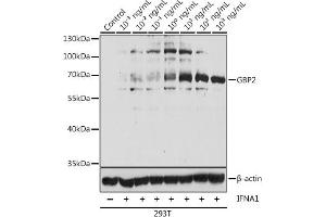 Western blot analysis of extracts of 293T cells, using GBP2 antibody  at 1:1000 dilution. (GBP2 antibody  (AA 410-520))