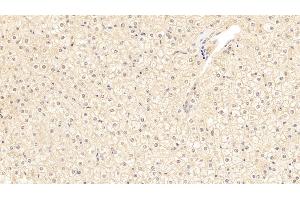 Detection of a1ACT in Human Liver Tissue using Polyclonal Antibody to Alpha-1-Antichymotrypsin (a1ACT) (SERPINA3 antibody  (AA 235-394))