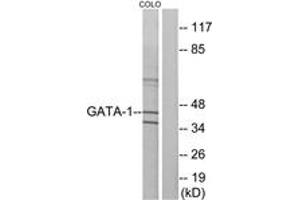 Western blot analysis of extracts from COLO cells, using GATA1 (Ab-142) Antibody. (GATA1 antibody  (AA 109-158))