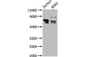 Western Blot Positive WB detected in: Jurkat whole cell lysate, K562 whole cell lysate All lanes: THEMIS antibody at 7. (THEMIS antibody  (AA 547-641))