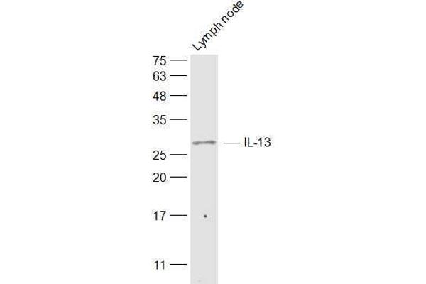 IL-13 antibody  (AA 45-56)