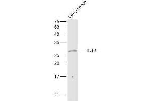 Mouse lymph node lysates probed with IL-13 Polyclonal Antibody, Unconjugated  at 1:500 dilution and 4˚C overnight incubation.