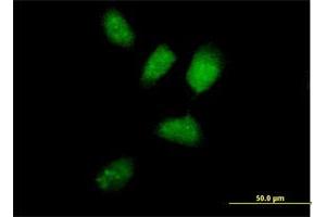 Immunofluorescence of purified MaxPab antibody to RNF8 on HeLa cell. (RNF8 antibody  (AA 1-485))