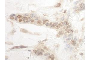 Immunohistochemistry (IHC) image for anti-AT Rich Interactive Domain 3B (BRIGHT-Like) (ARID3B) (AA 511-561) antibody (ABIN7454840)
