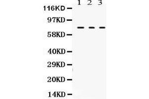 Anti- TGM2 Picoband antibody, Western blotting All lanes: Anti TGM2  at 0. (Transglutaminase 2 antibody  (N-Term))
