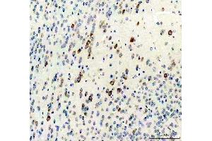 IHC analysis of Survivin/Calcitonin/CALCA using anti-Survivin/Calcitonin/CALCA antibody (ABIN4886497). (CGRP antibody  (C-Term))