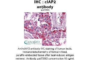 Image no. 2 for anti-Baculoviral IAP Repeat Containing 3 (BIRC3) (AA 314-508) antibody (ABIN1733088) (BIRC3 antibody  (AA 314-508))