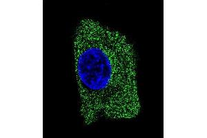 Confocal immunofluorescent analysis of LP2 Antibody 1851b with HepG2 cell followed by Alexa Fluor® 488-conjugated goat anti-mouse lgG (green). (LAMP2 antibody)