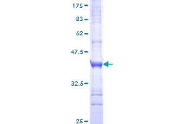 GLP2R Protein (AA 69-178) (GST tag)